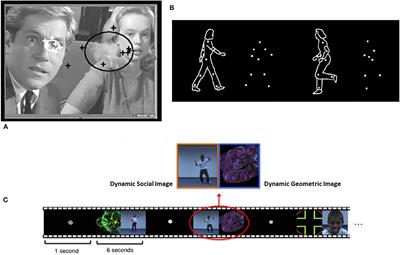 The Bidirectional Social-Cognitive Mechanisms of the Social-Attention Symptoms of Autism
